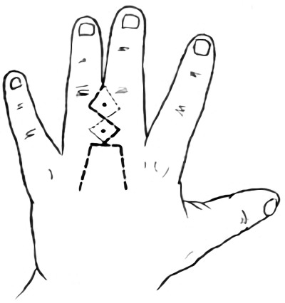 ָ