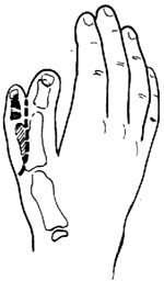 ָ