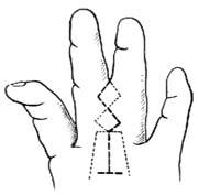 ָ