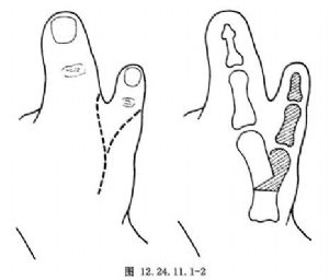 ָ