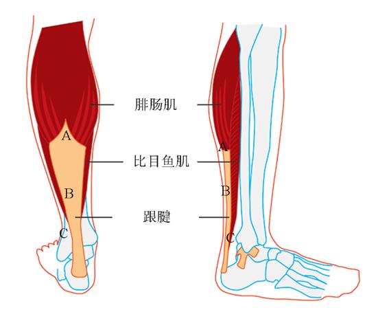 跟腱断裂是什么感觉跟腱断裂恢复要多久