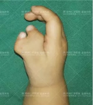 ָ