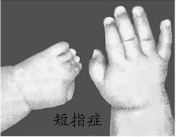 ΪʲôỼָأ