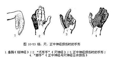 α