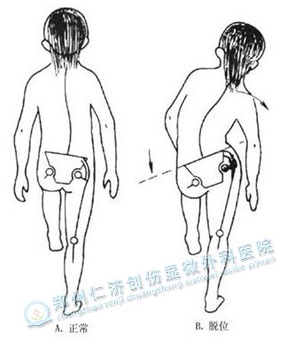 Թ