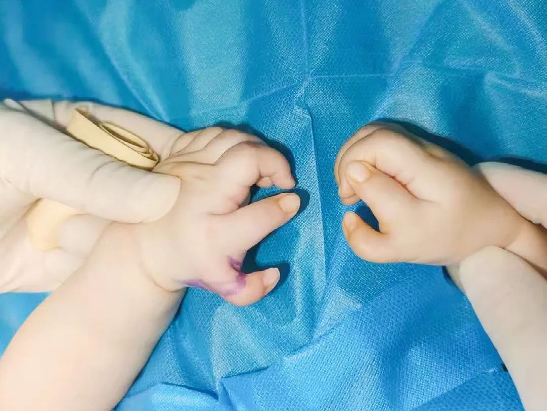 ͼƬ