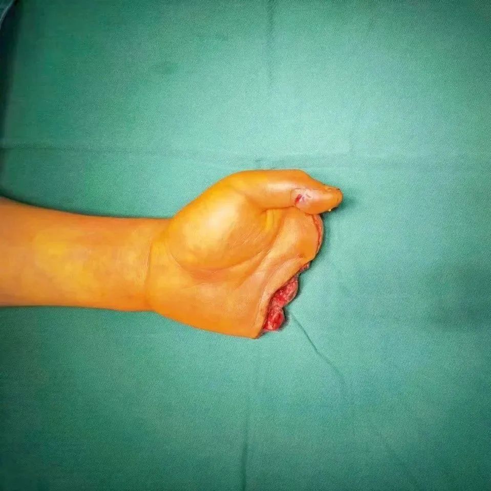 ͼƬ