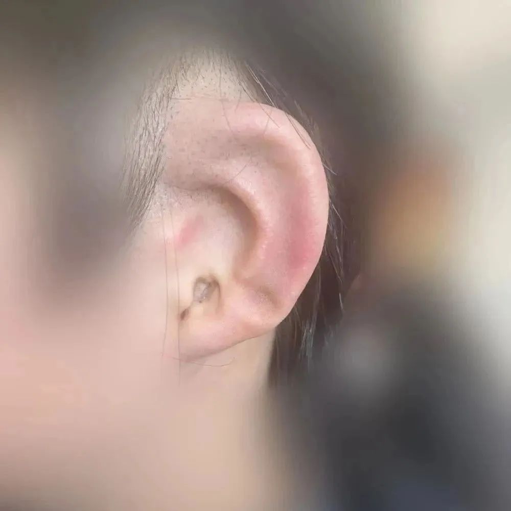 ͼƬ