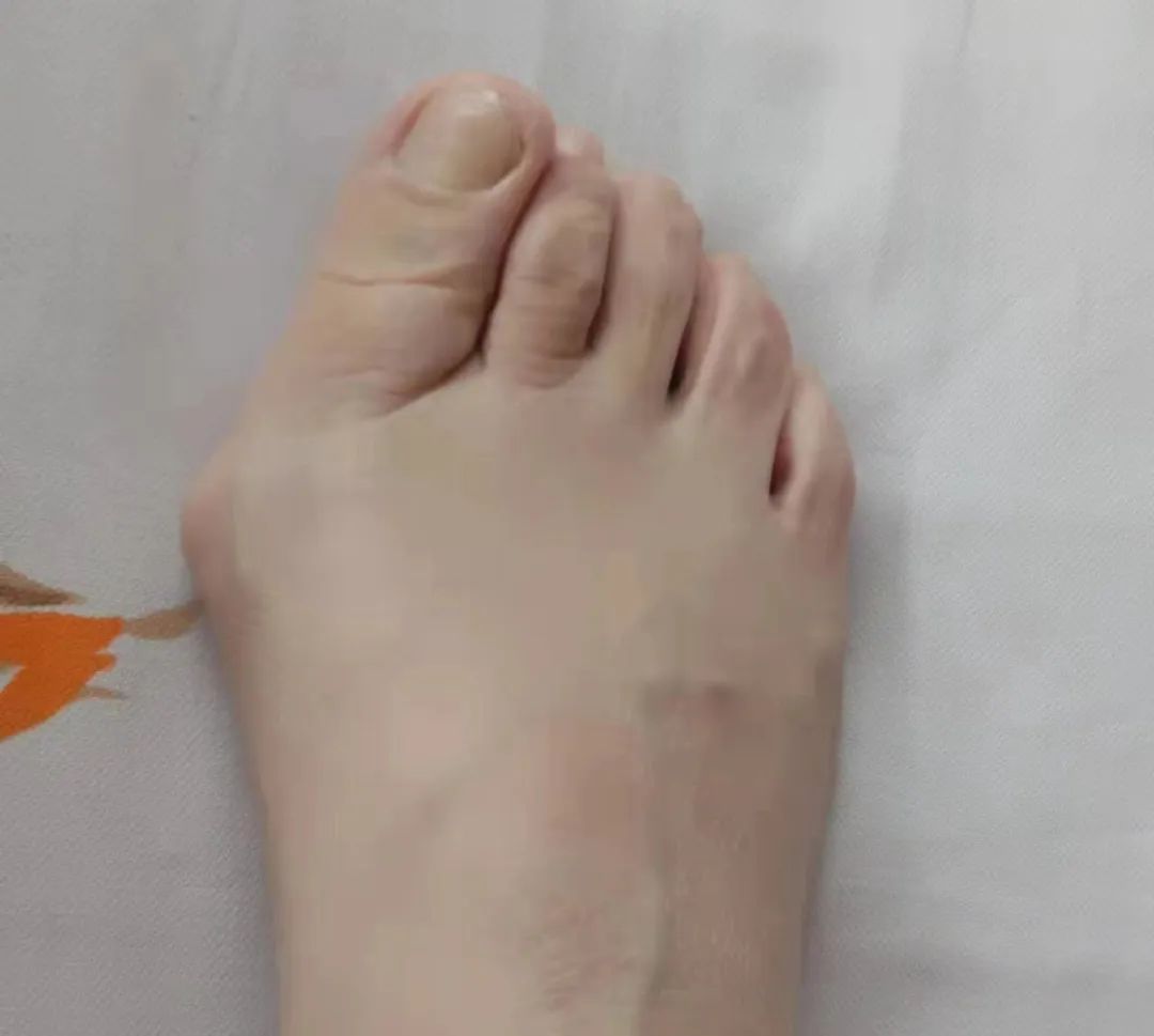 ͼƬ