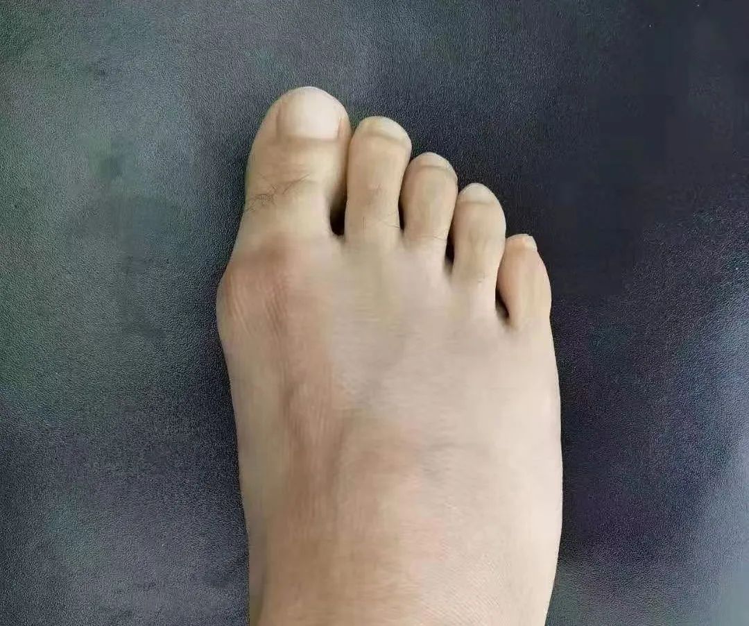 ͼƬ