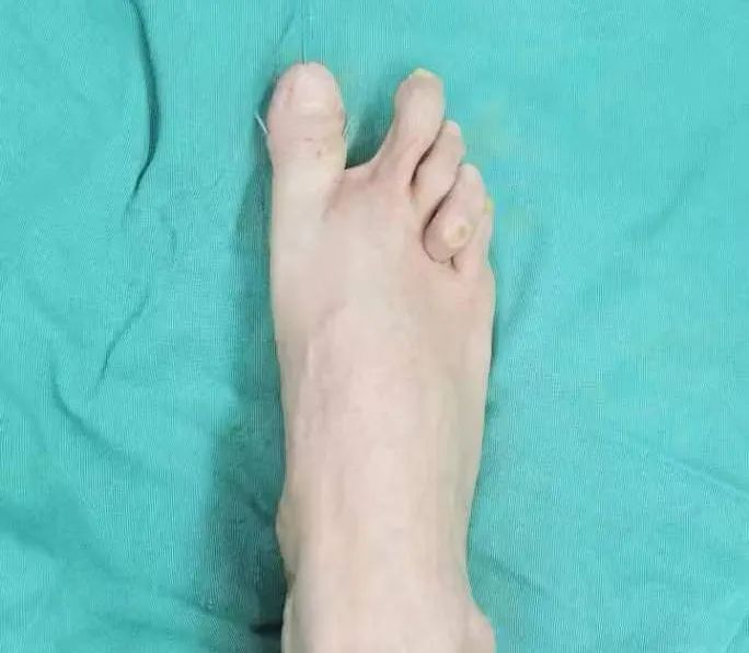 ͼƬ