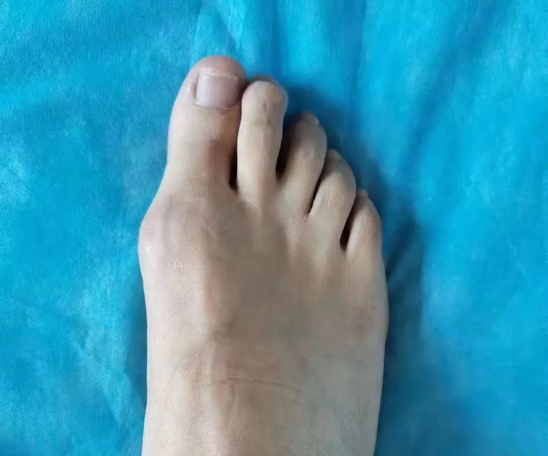 ͼƬ