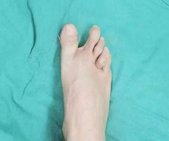 ͼƬ