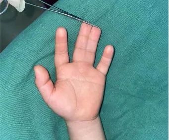 ͼƬ