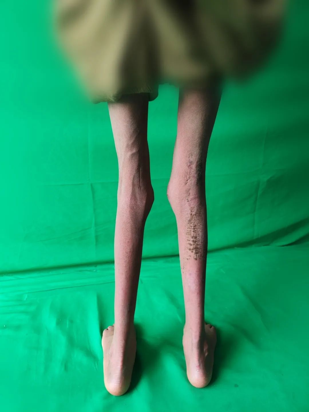 ͼƬ