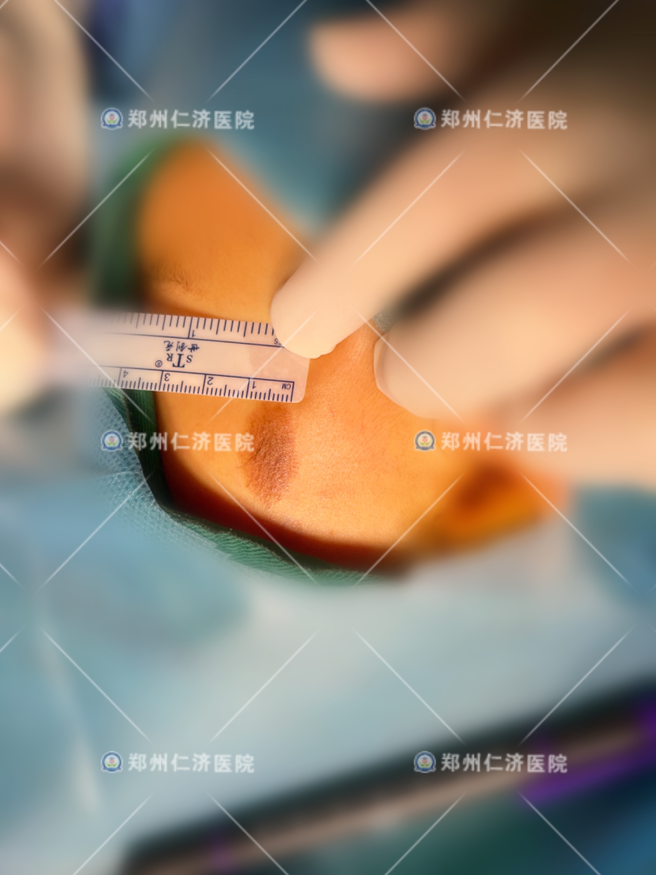 ͼƬ