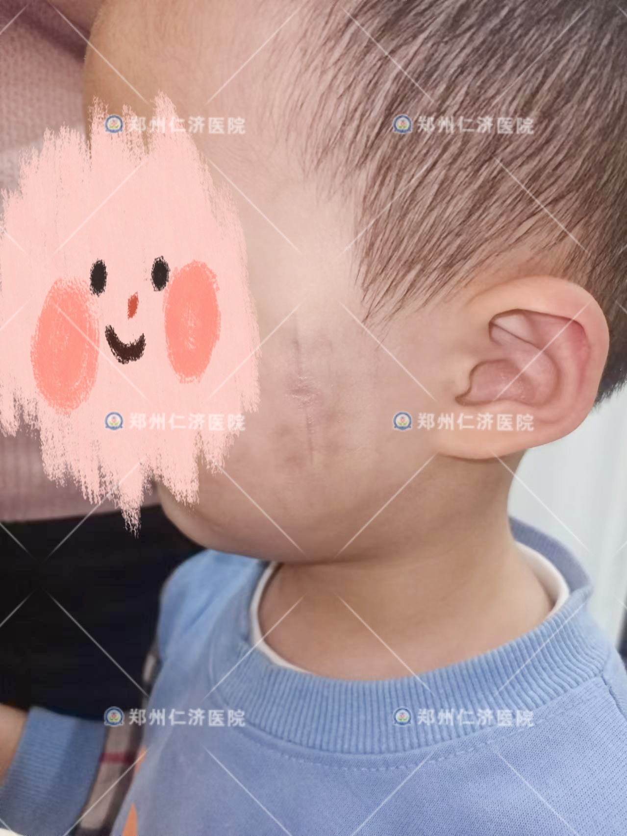 ͼƬ