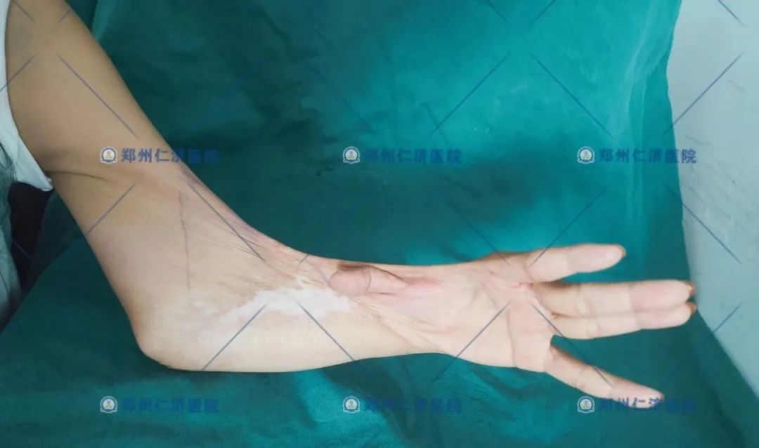 ͼƬ