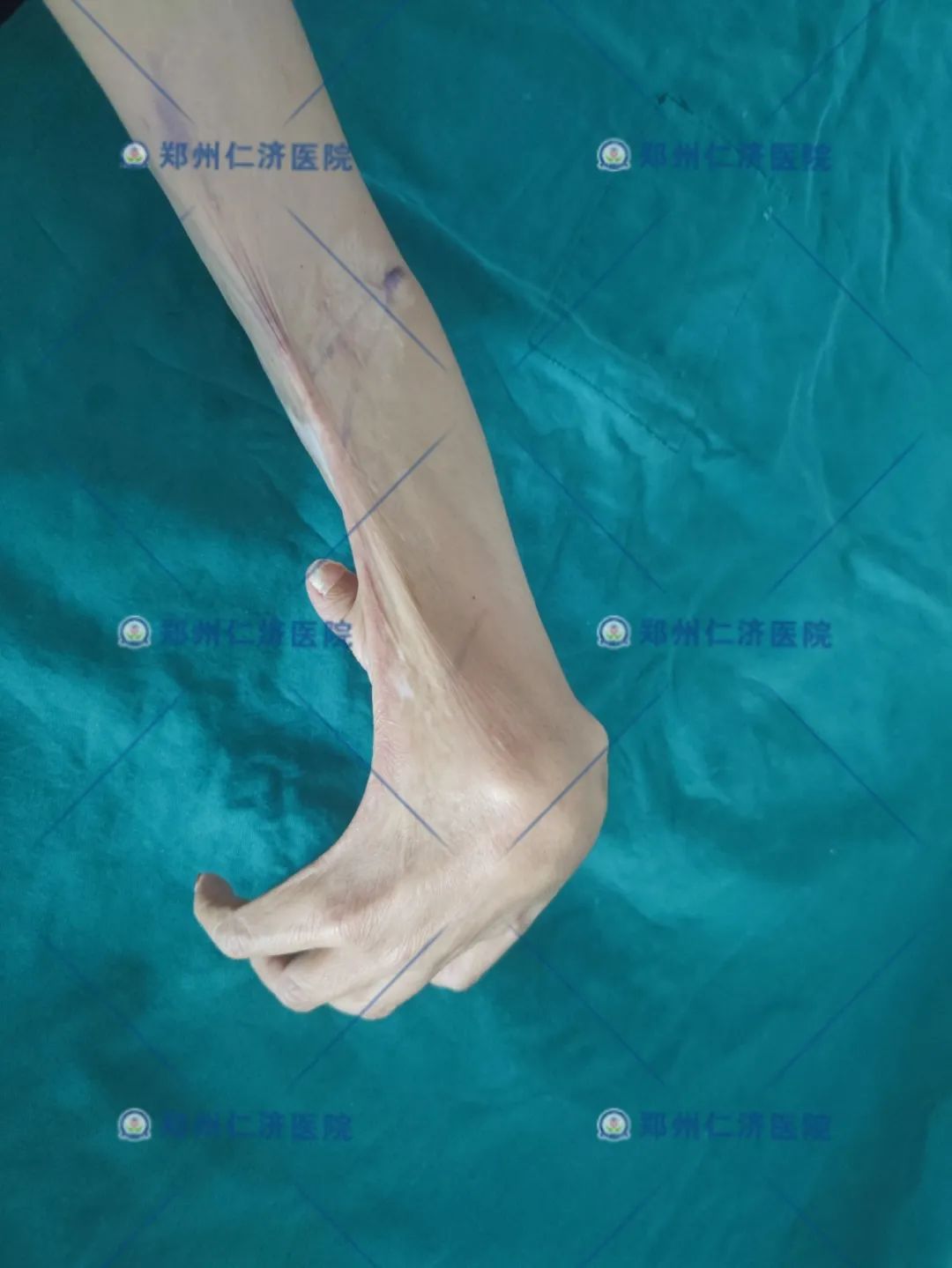 ͼƬ