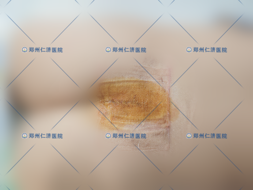 ͼƬ