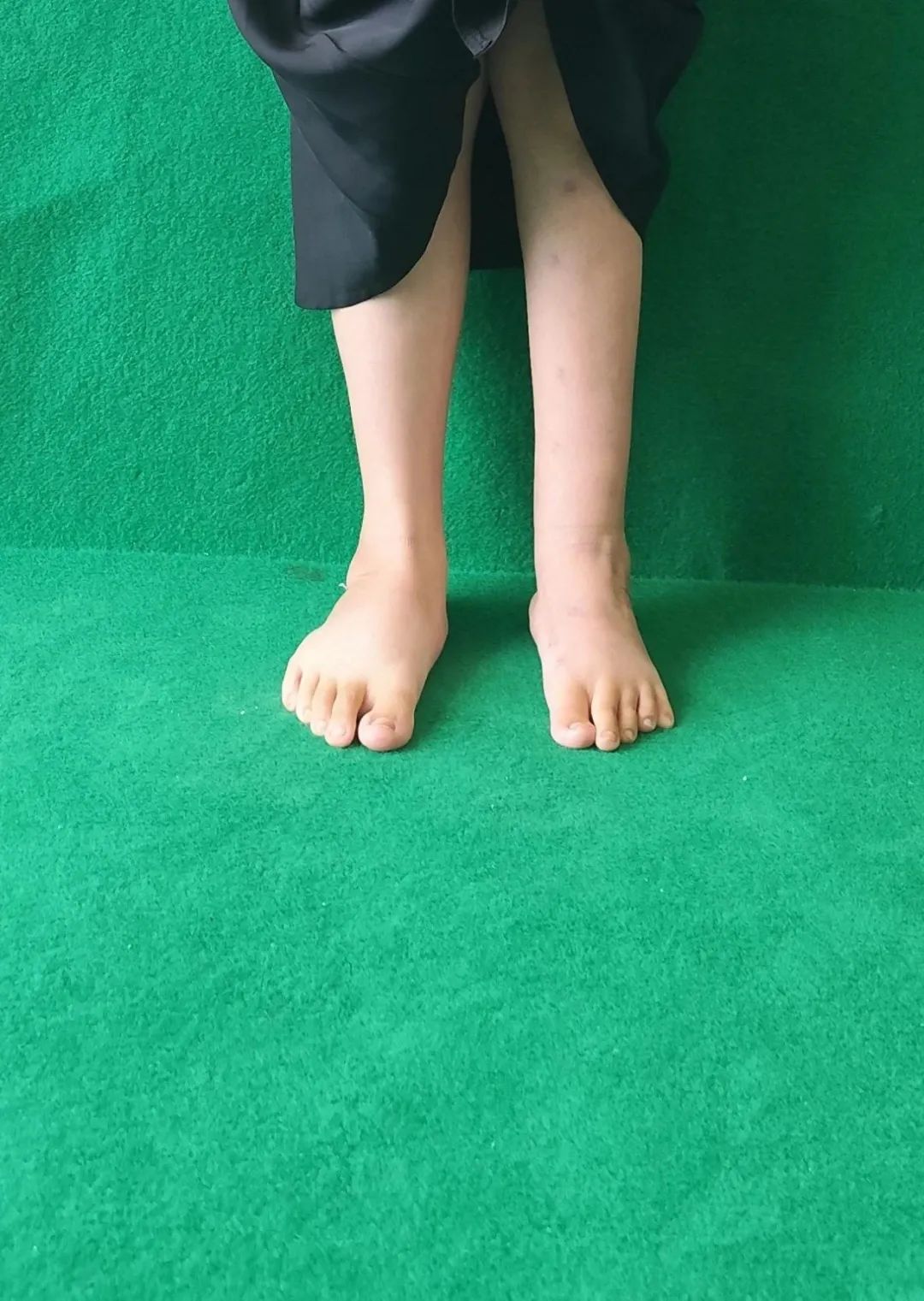 ͼƬ