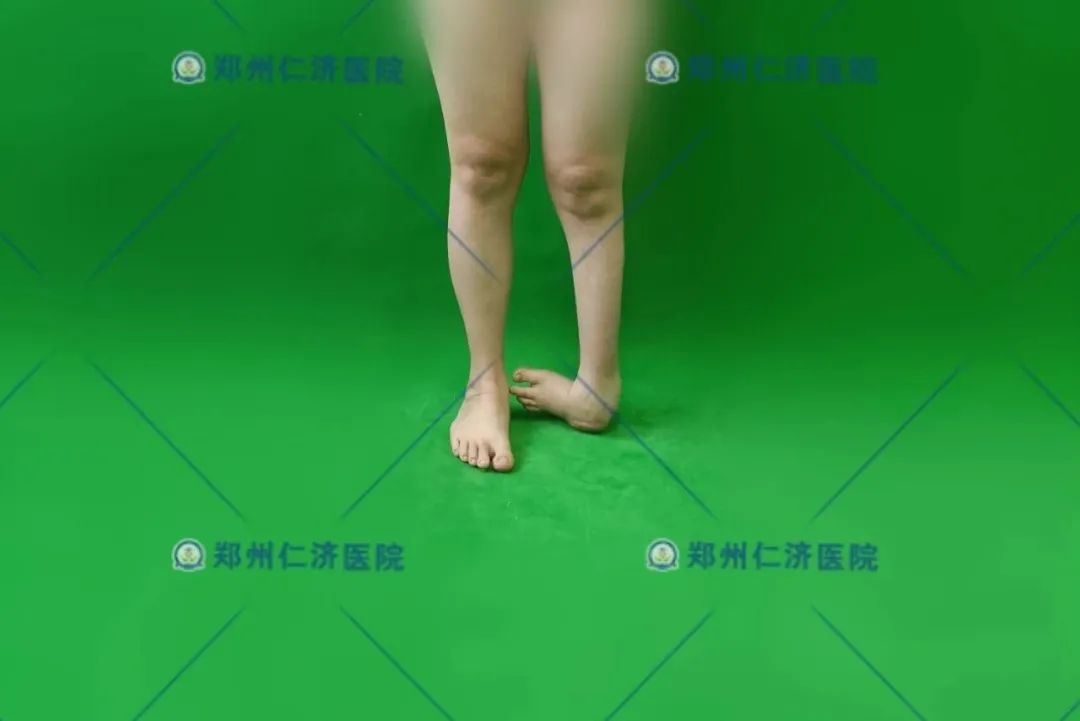 ͼƬ
