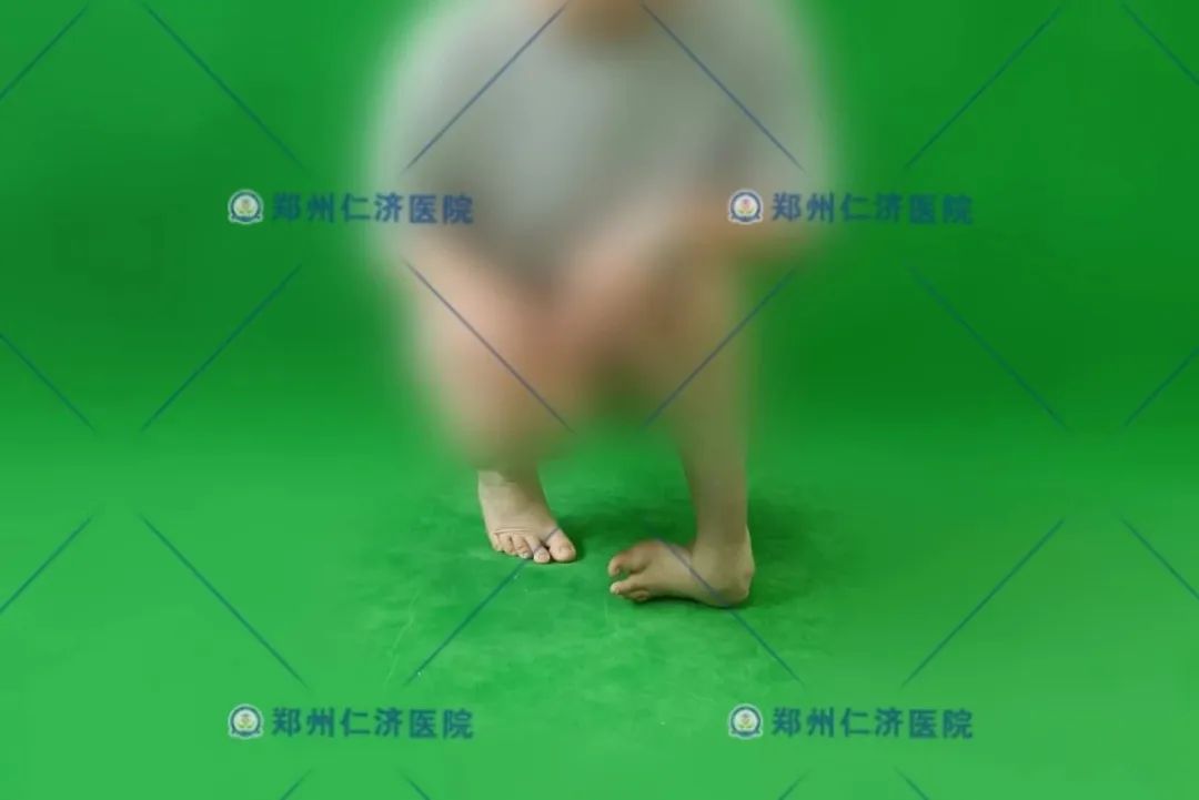 ͼƬ