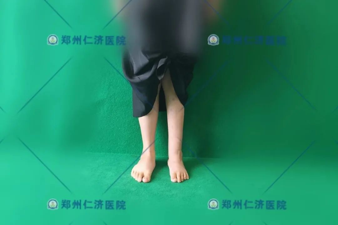 ͼƬ