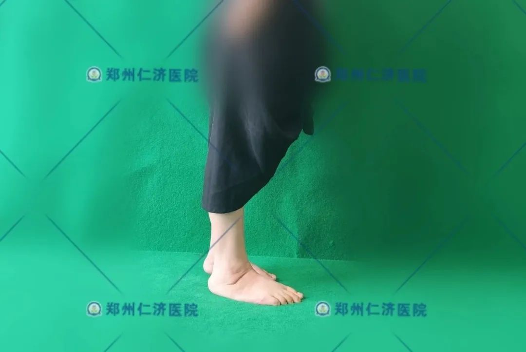 ͼƬ