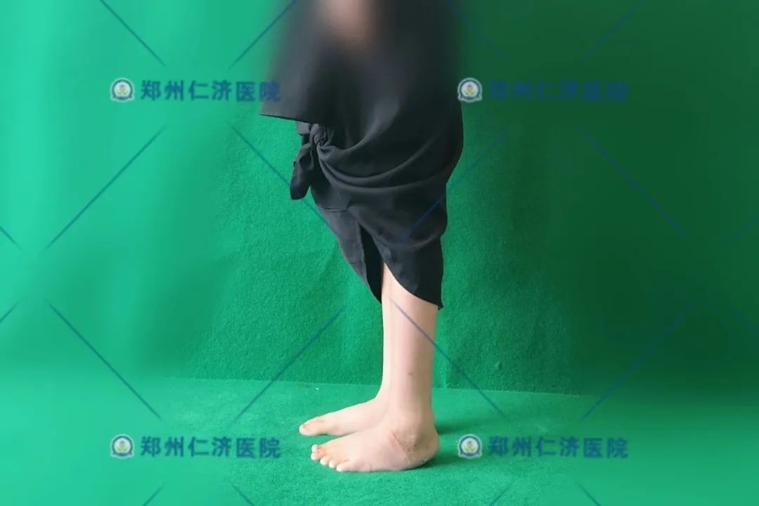 ͼƬ