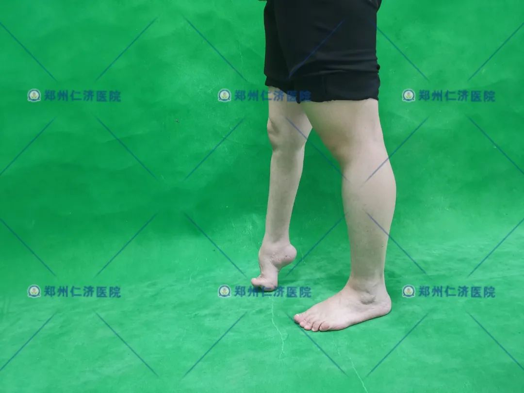 ͼƬ