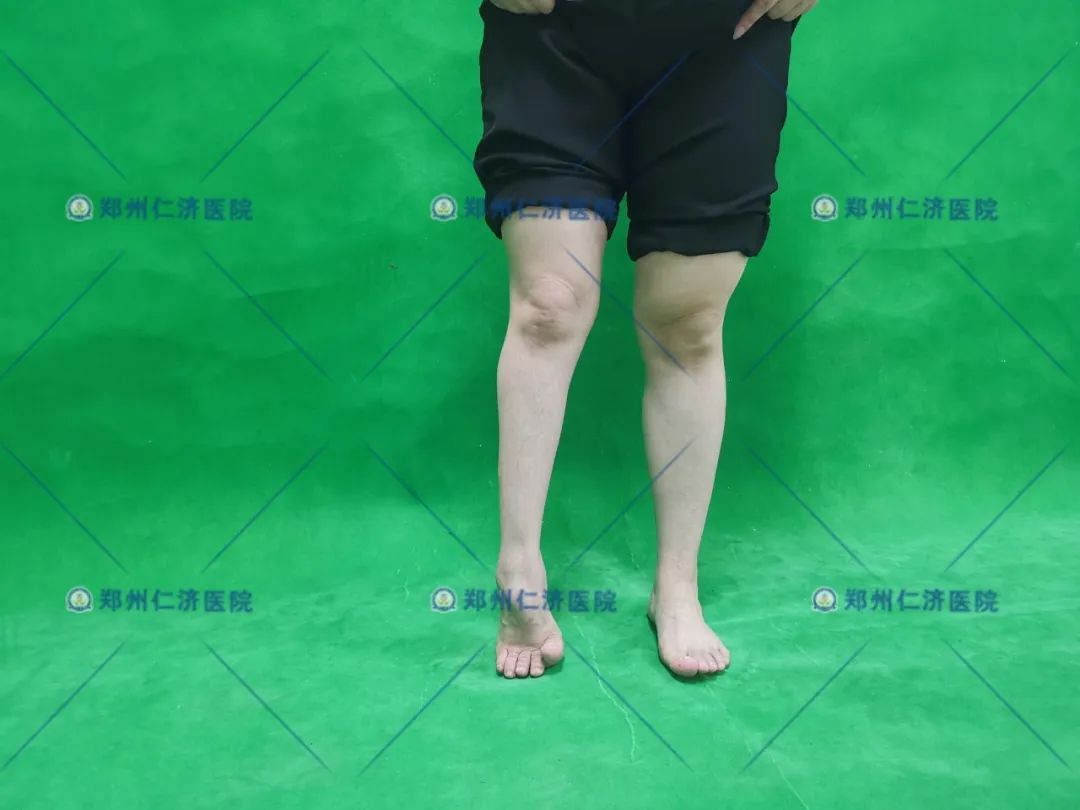 ͼƬ