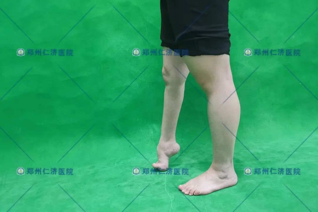 ͼƬ