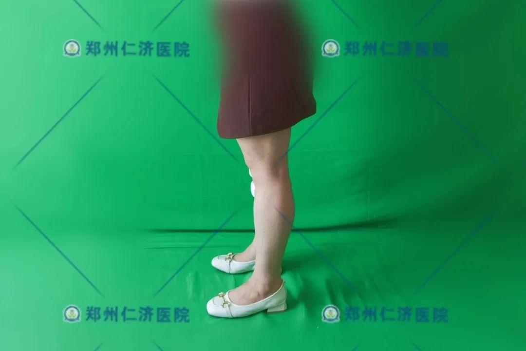 ͼƬ
