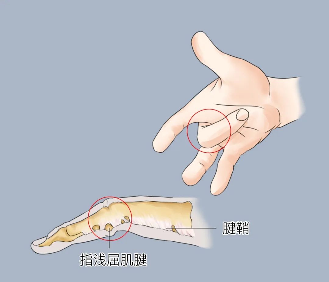 ͼƬ