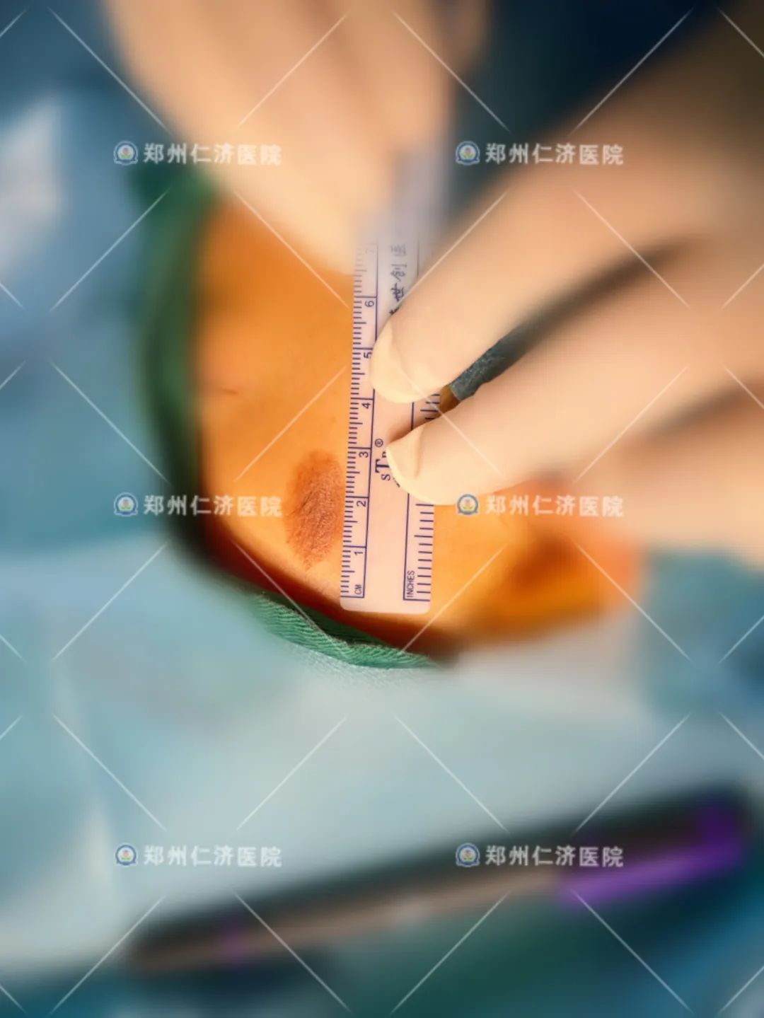 ͼƬ