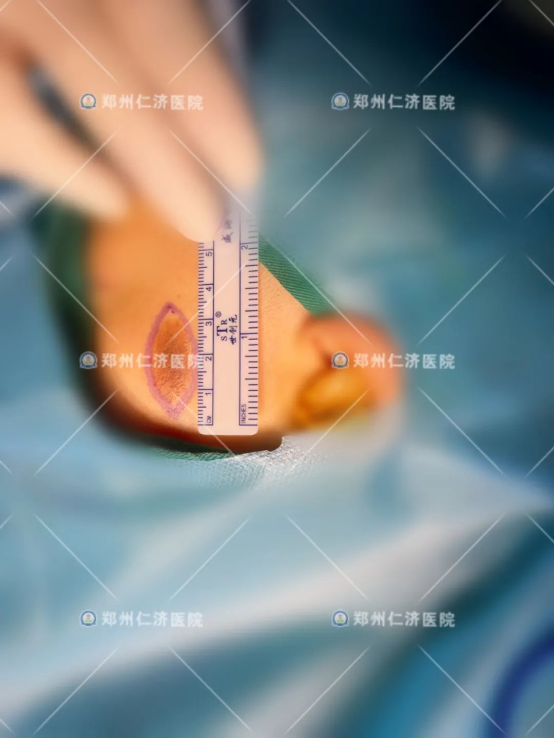 ͼƬ