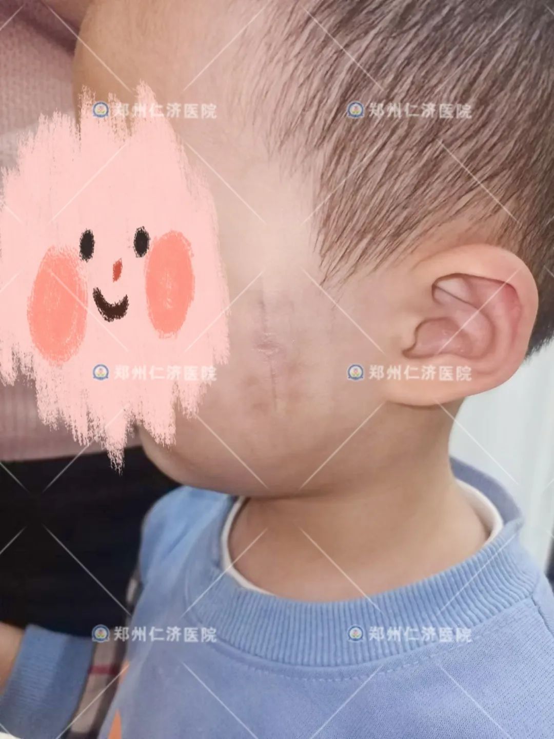 ͼƬ