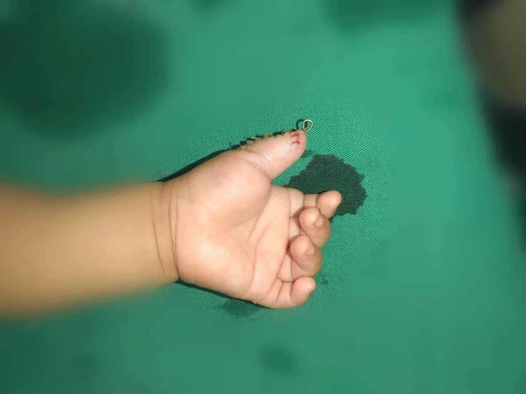 ͼƬ