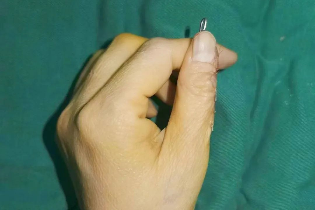 ͼƬ