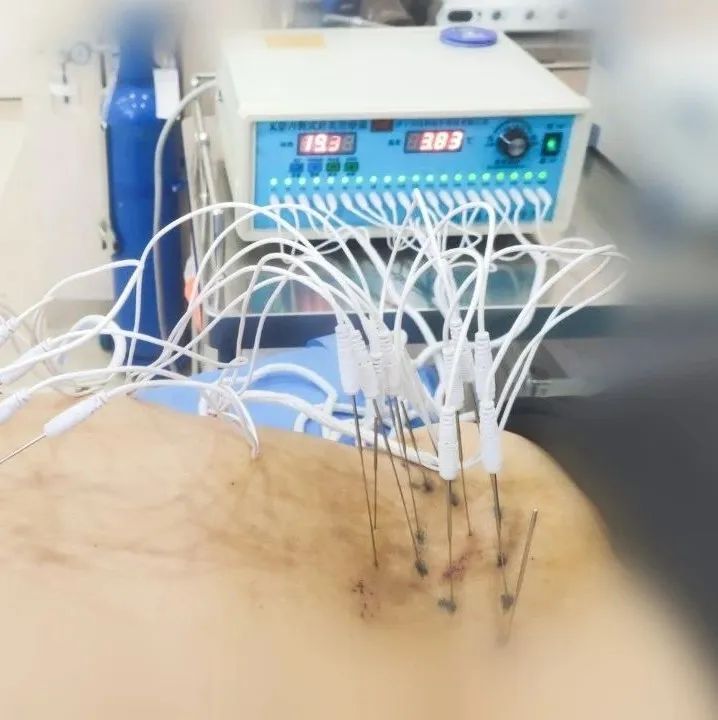 ͼƬ