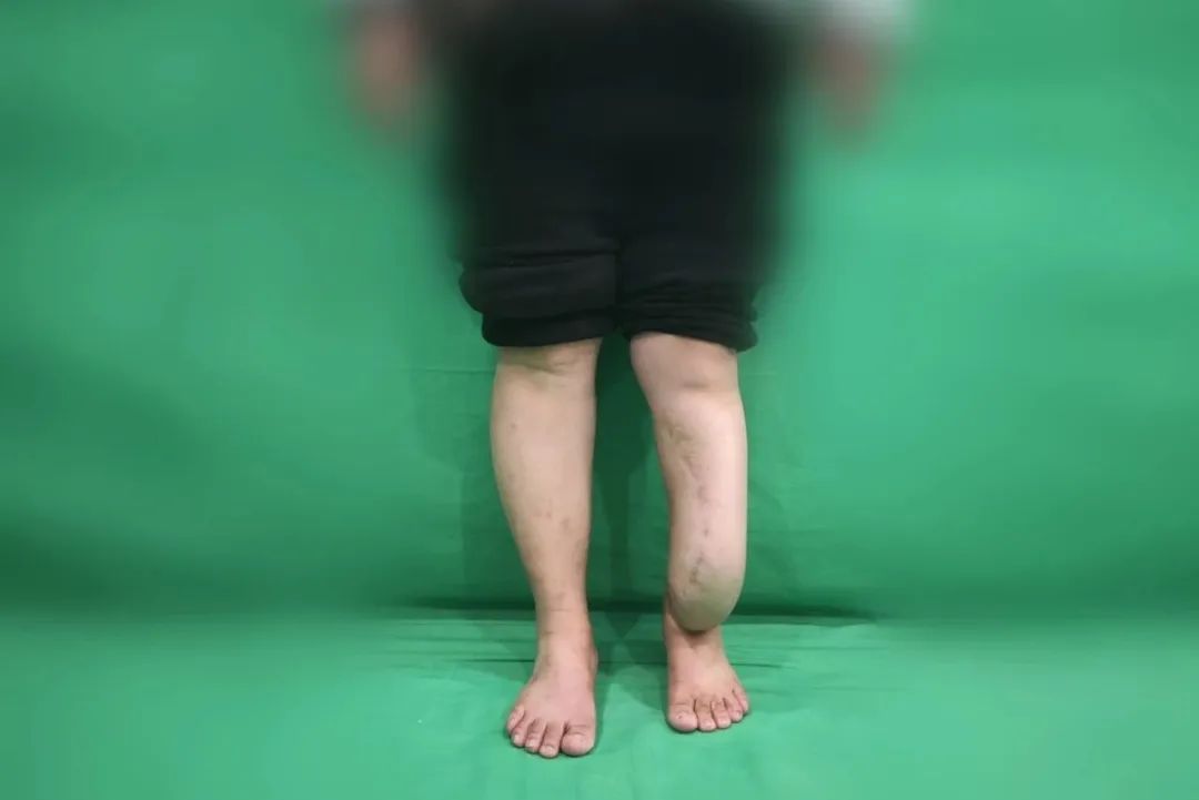 ͼƬ