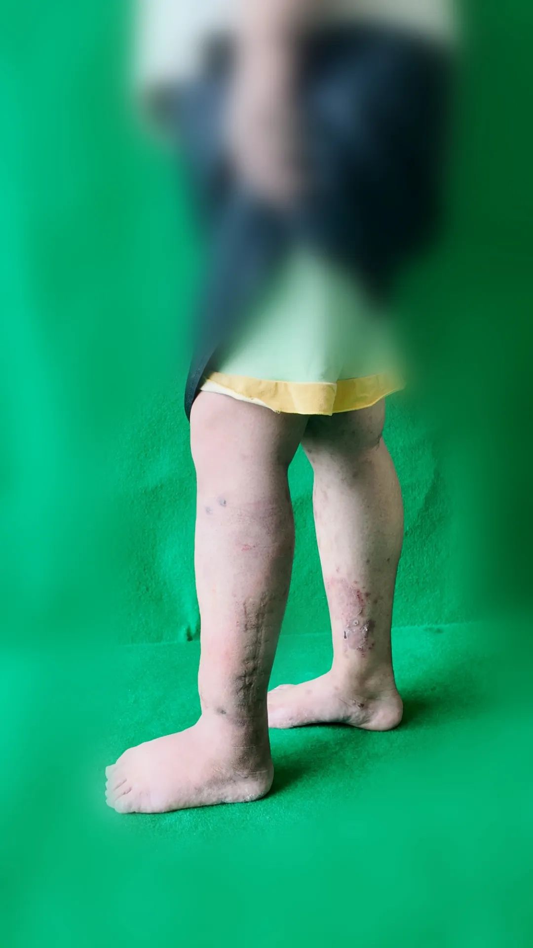 ͼƬ