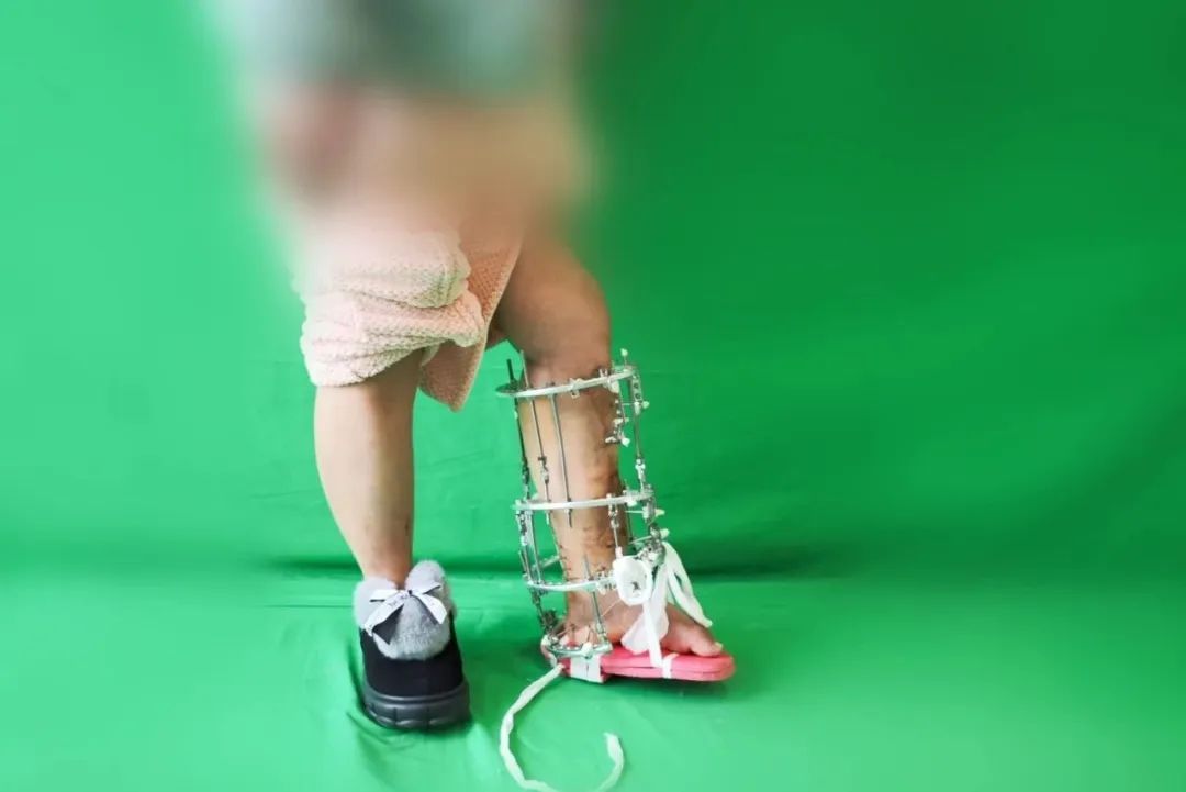 ͼƬ
