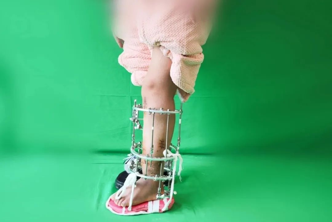 ͼƬ