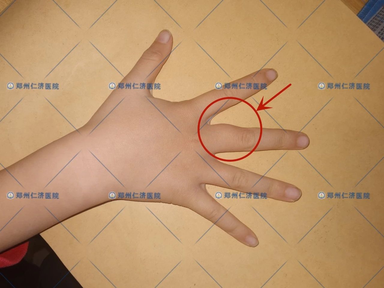 ͼƬ