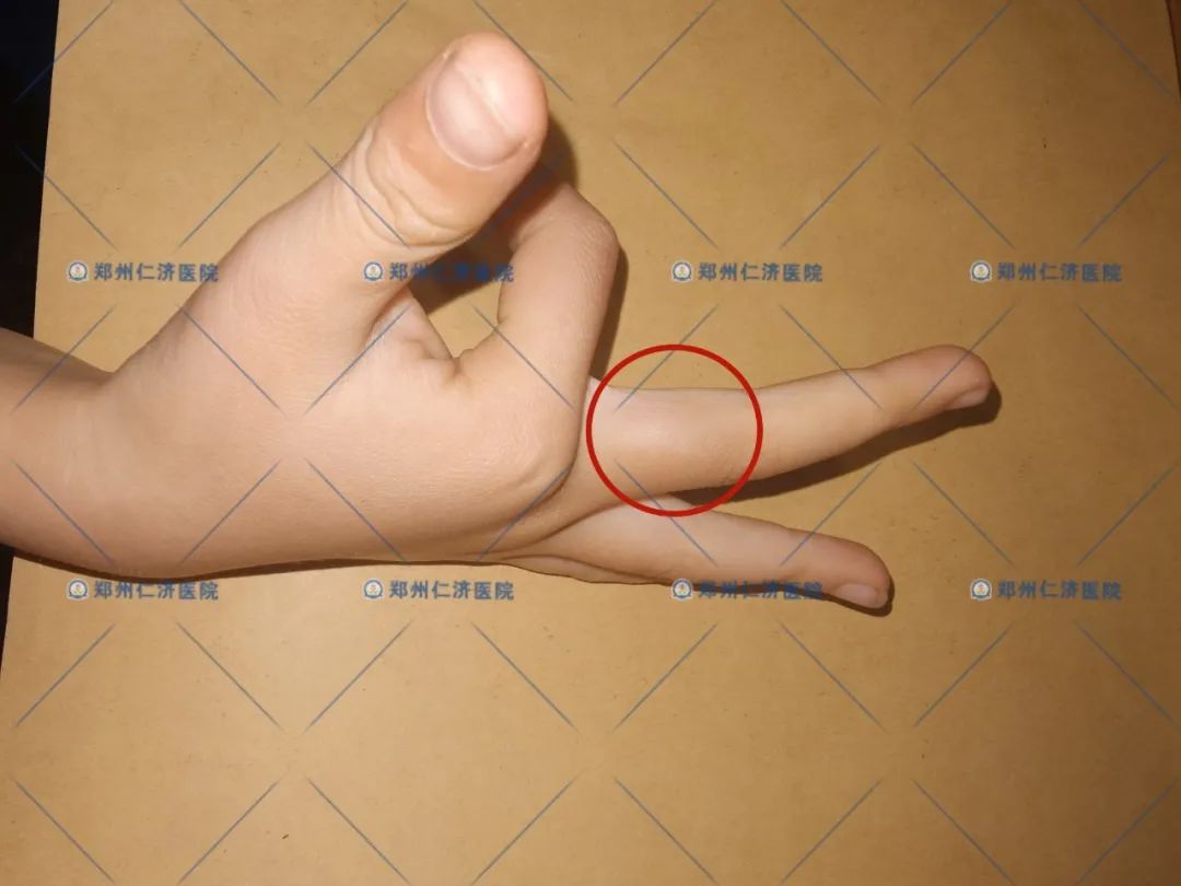 ͼƬ