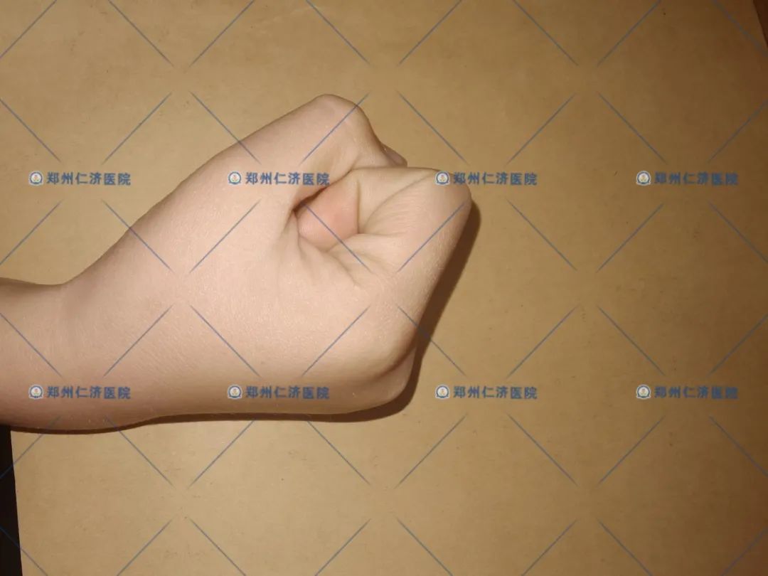 ͼƬ