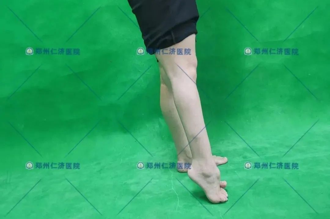 ͼƬ