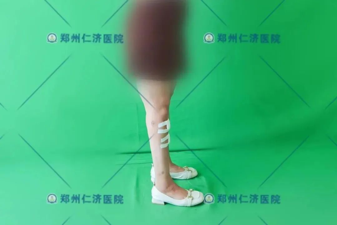 ͼƬ